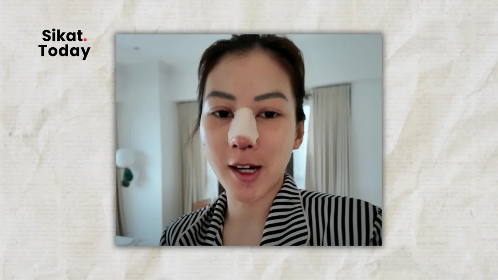 Courtesy : Alex Gonzaga