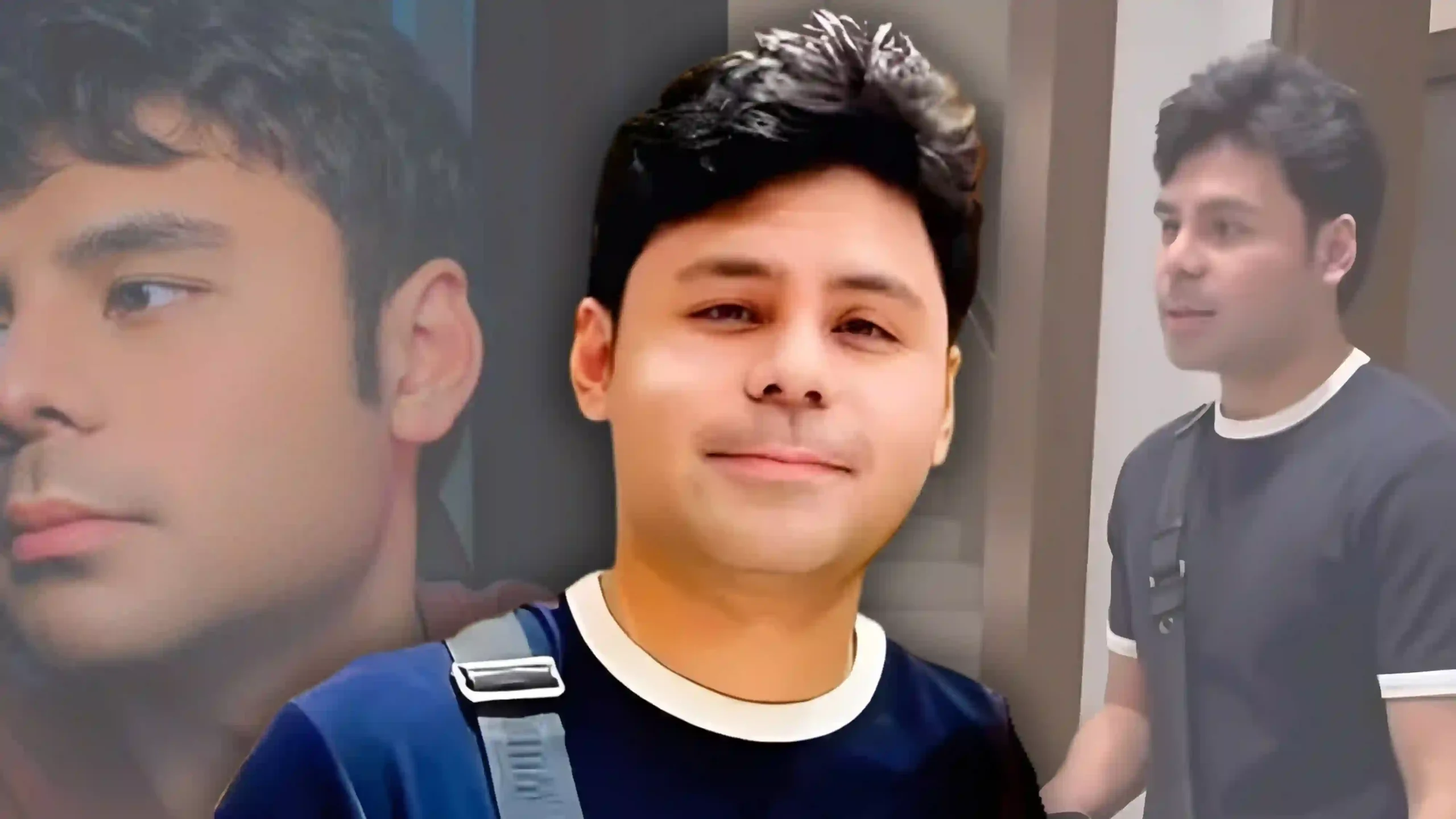 Michael Pacquiao undergoes nose job or rhinoplasty