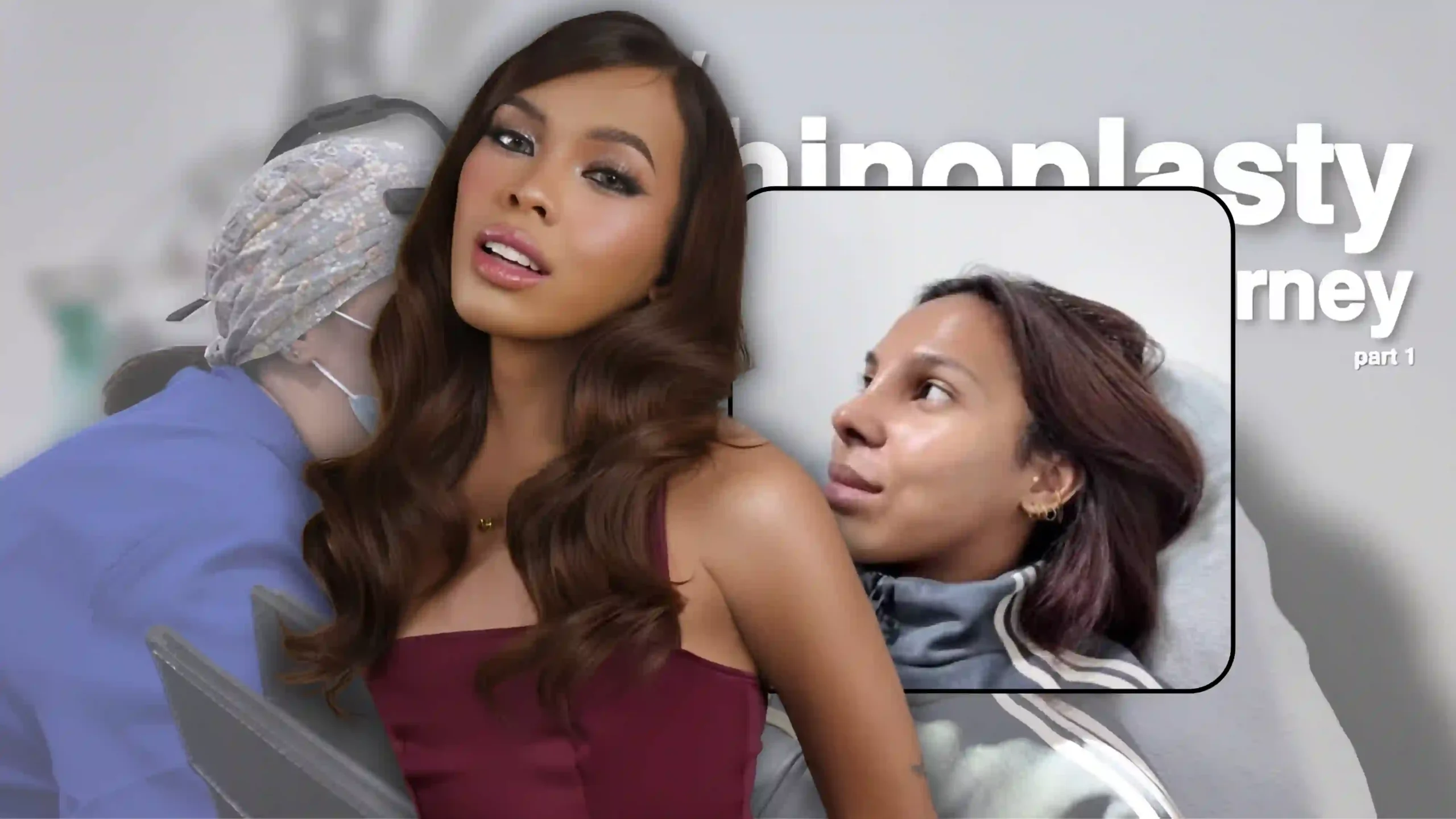 Awra Briguela Undergoes Nose Surgery