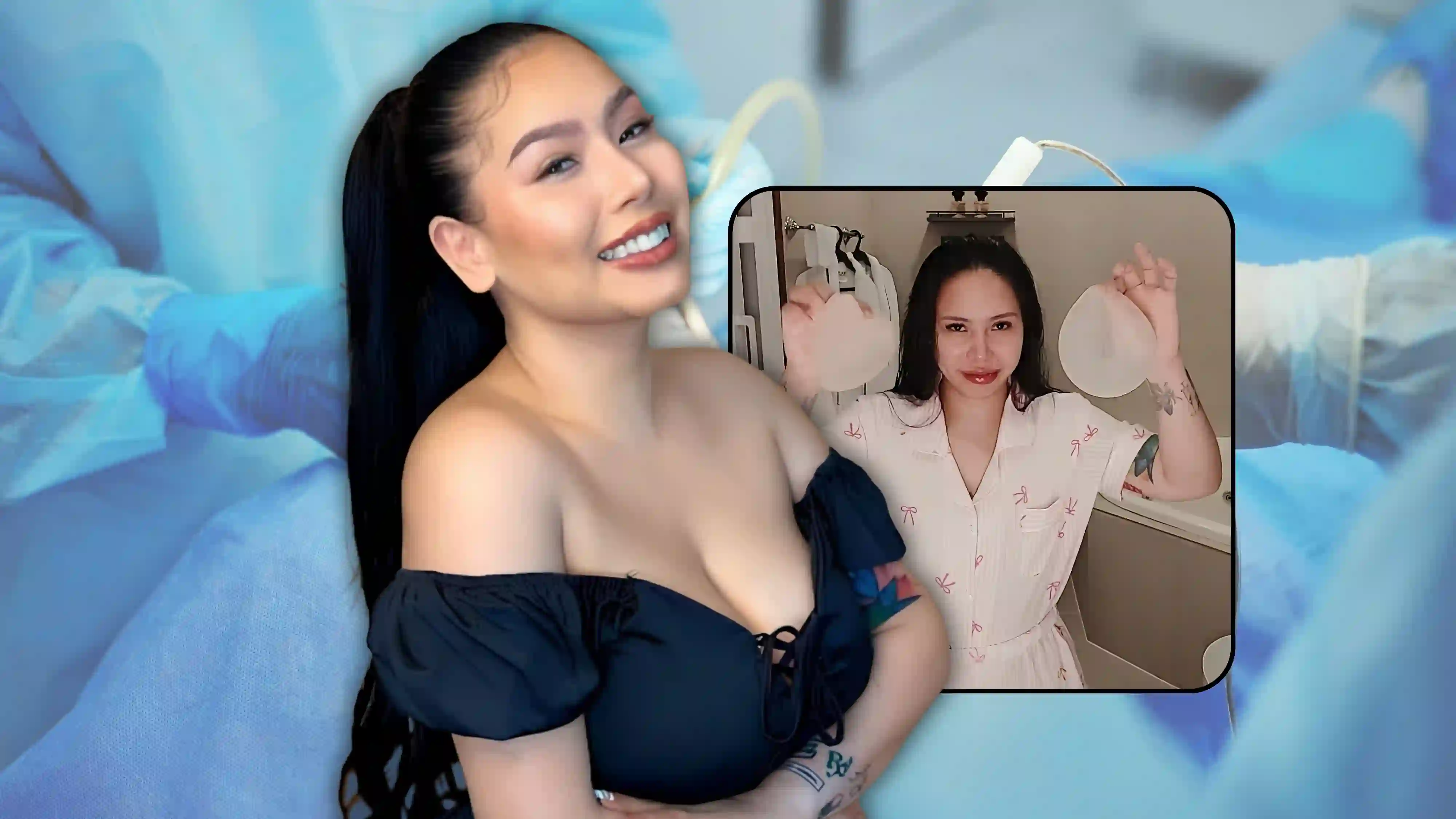 Toni Fowler removes breast implants after 10 years